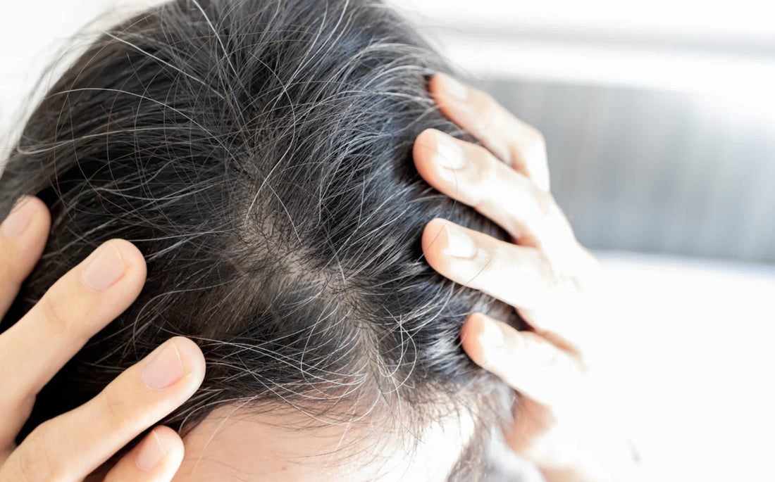 Spermidinas vs žili plaukai